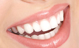 سفید کردن دندان ها با لیزر